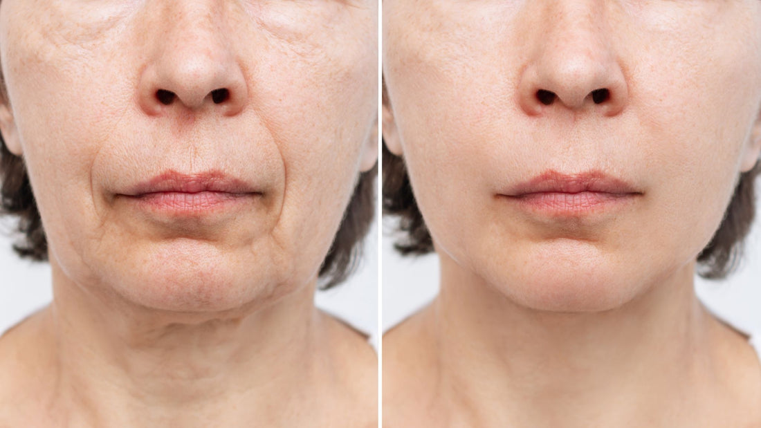 Firm Skin: Age-Defying Solutions for Tighter Skin