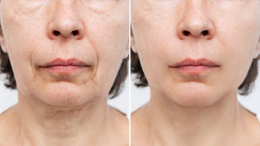 Firm Skin: Age-Defying Solutions for Tighter Skin