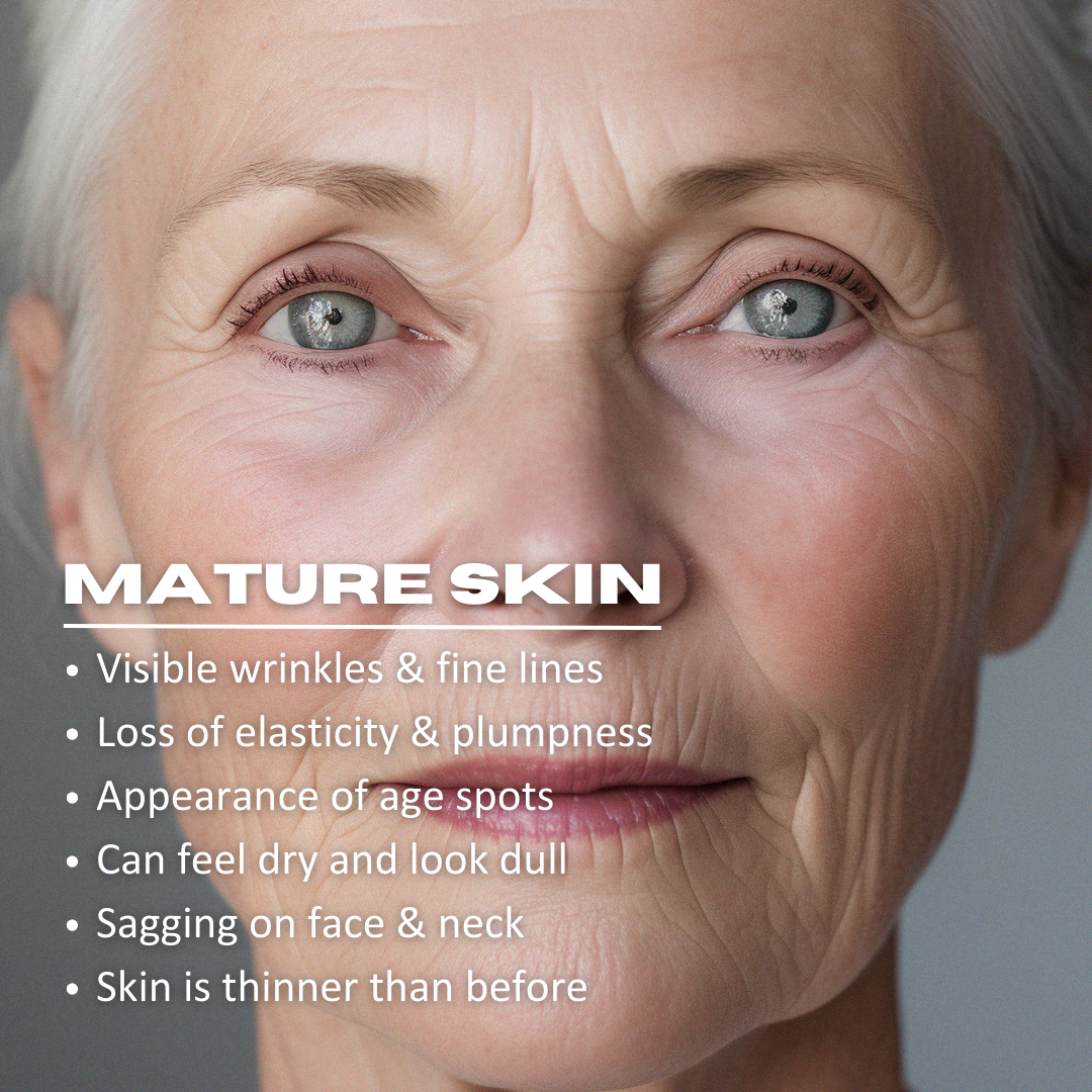 mature skin