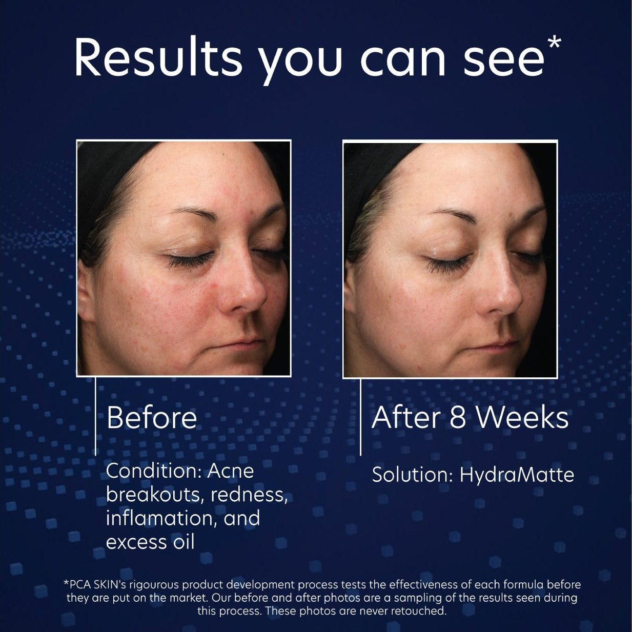 PCA Skin HydraMatte