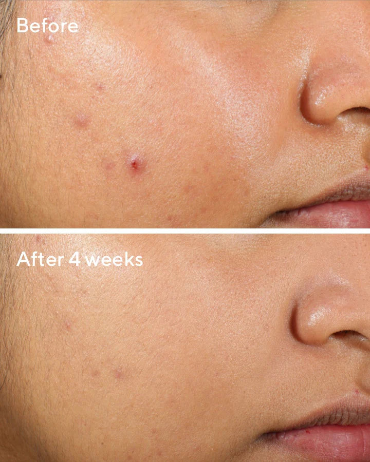 Murad Clarifying Water Gel