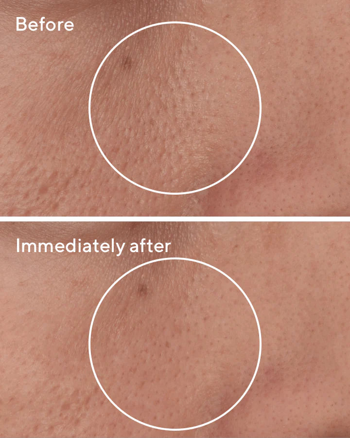 Murad Targeted Pore Corrector