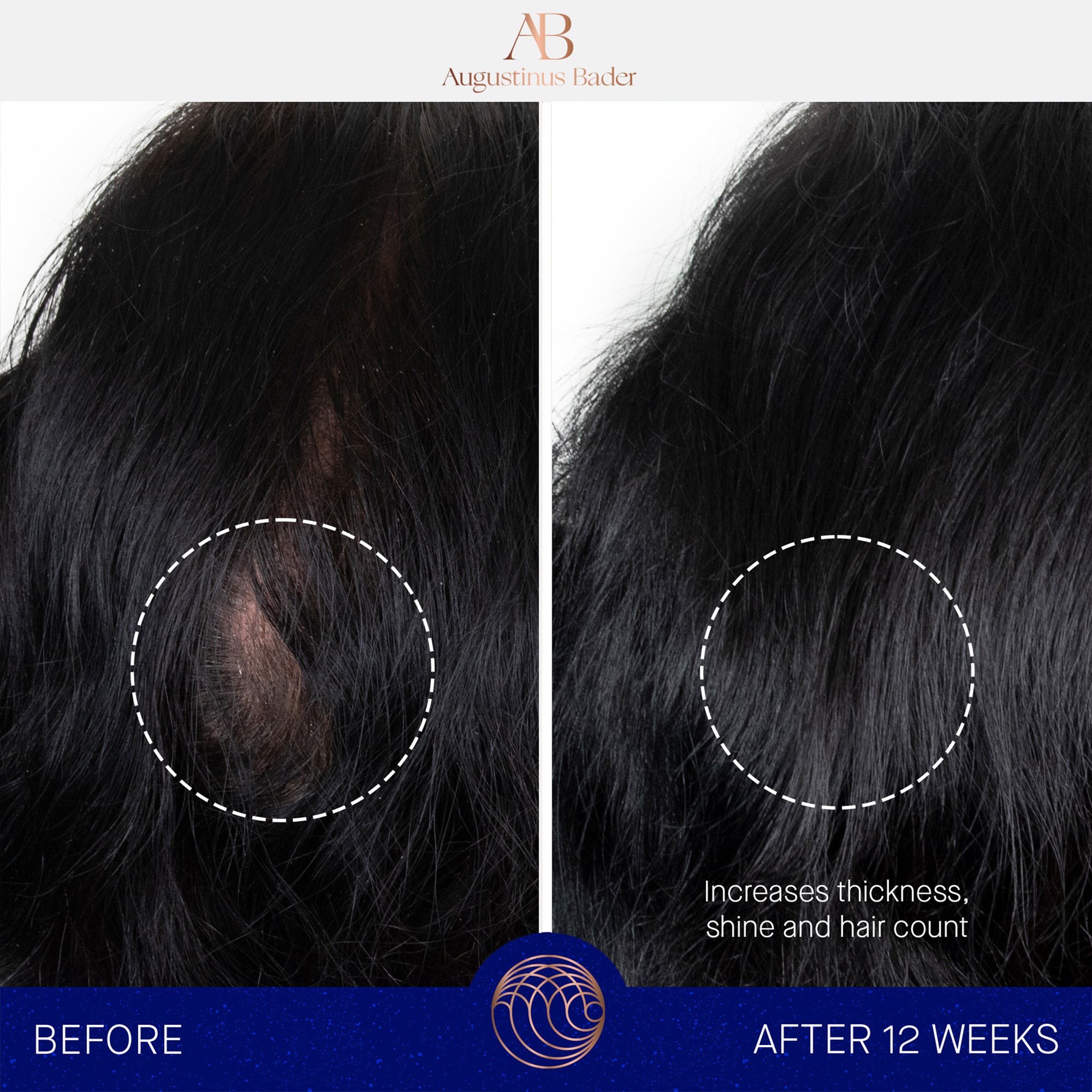 Augustinus Bader The Scalp Treatment
