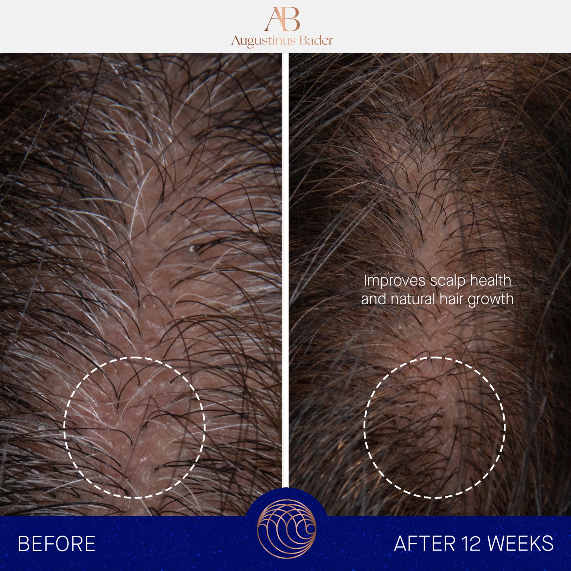 Augustinus Bader The Scalp Treatment