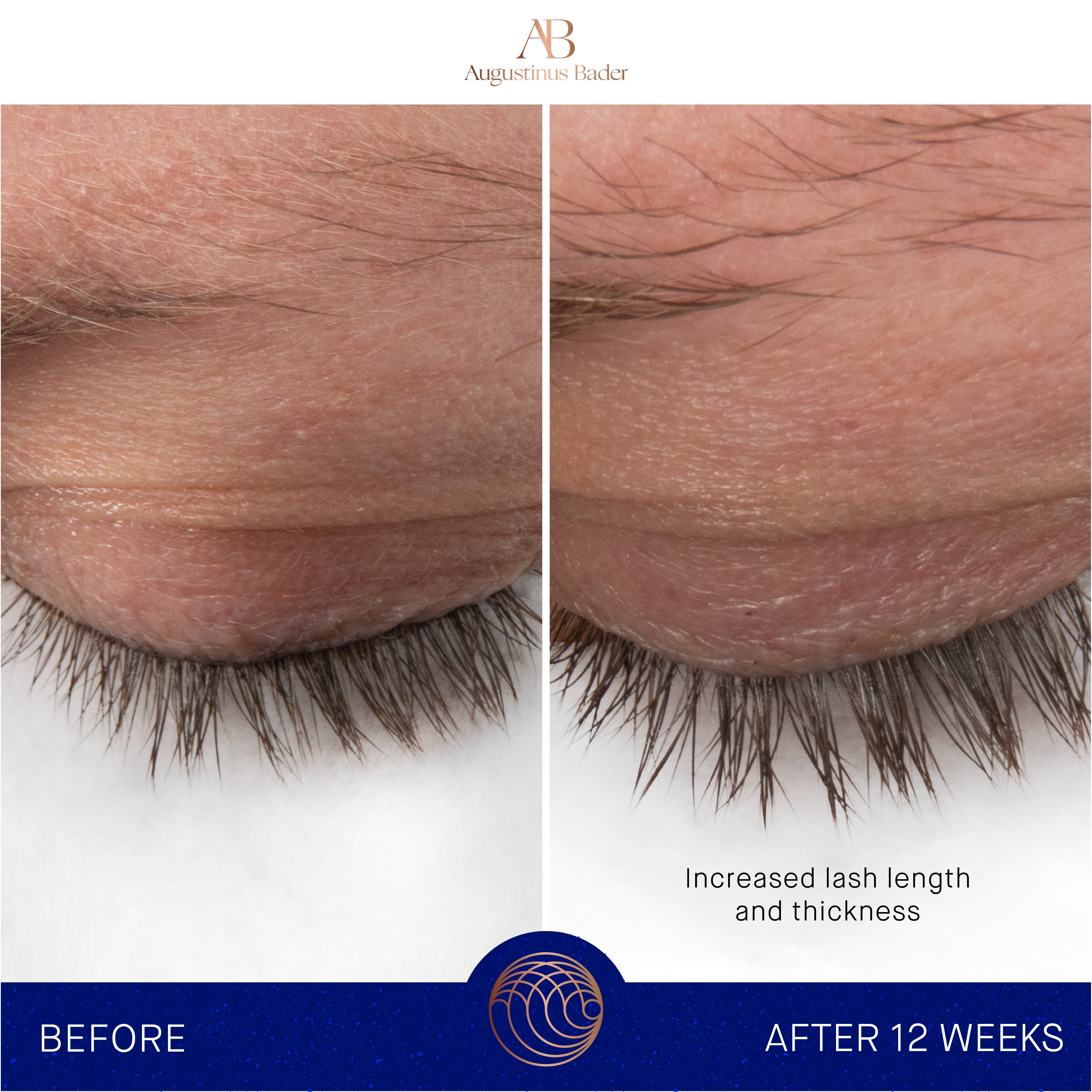 Augustinus Bader The Eyebrow & Lash Enhancing Serum