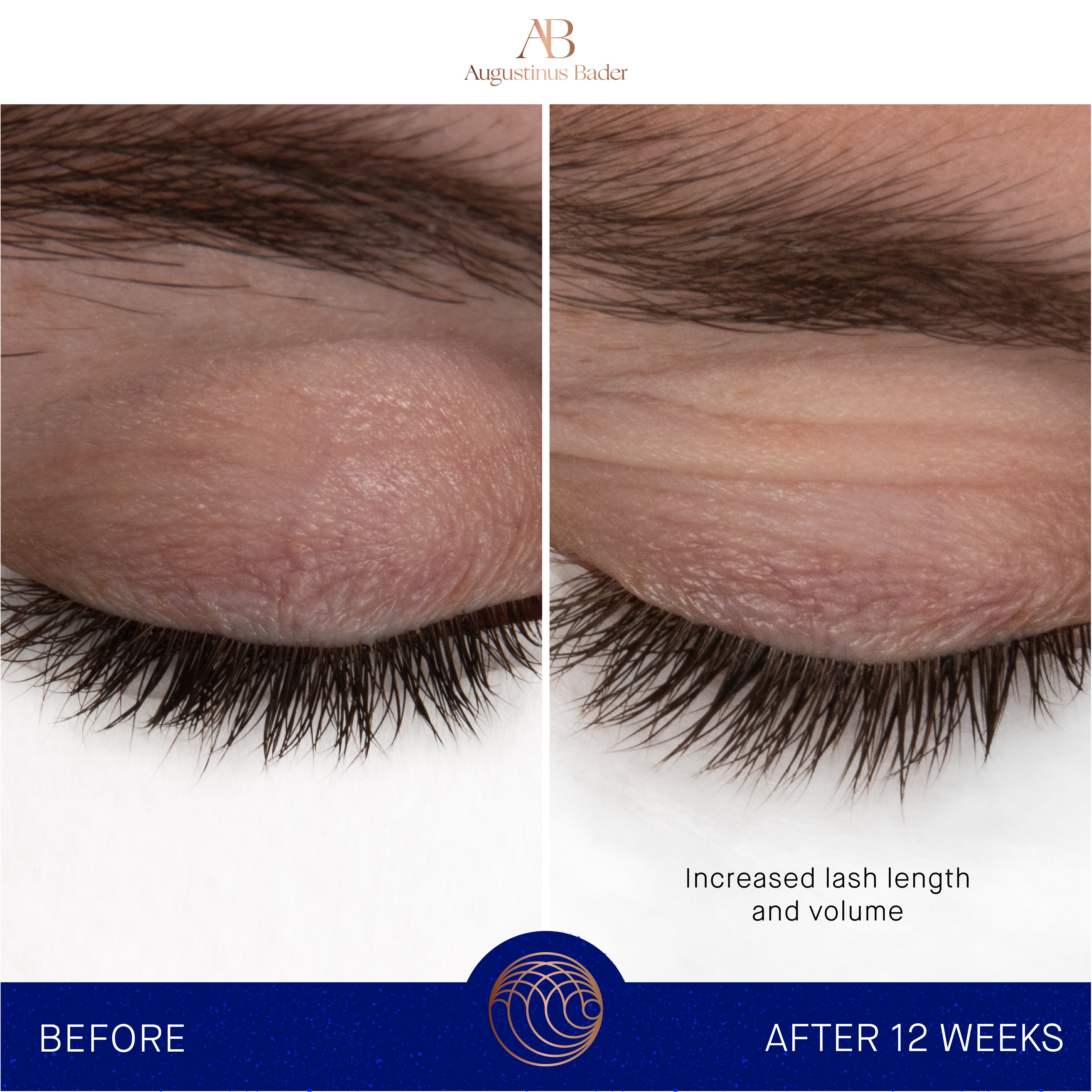 Augustinus Bader The Eyebrow & Lash Enhancing Serum