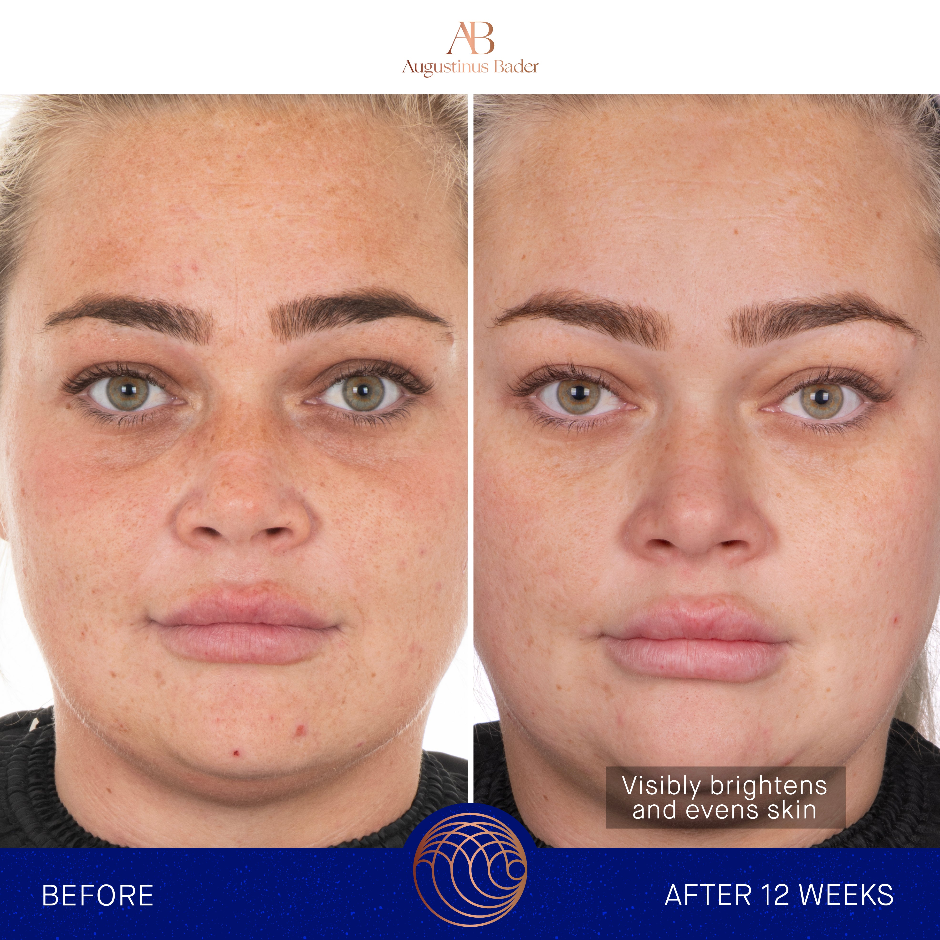 Augustinus Bader The Face Cream Mask