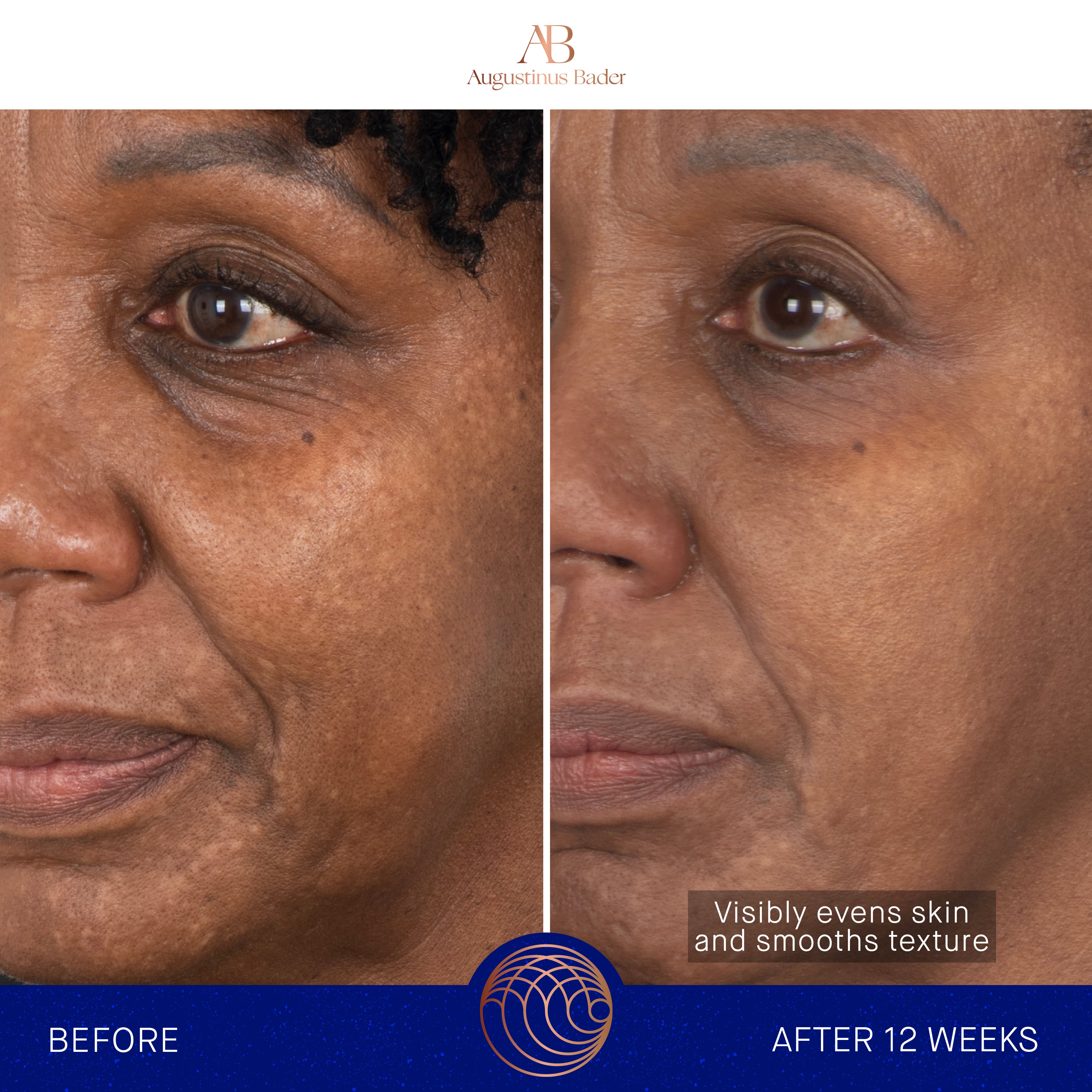 Augustinus Bader The Face Cream Mask