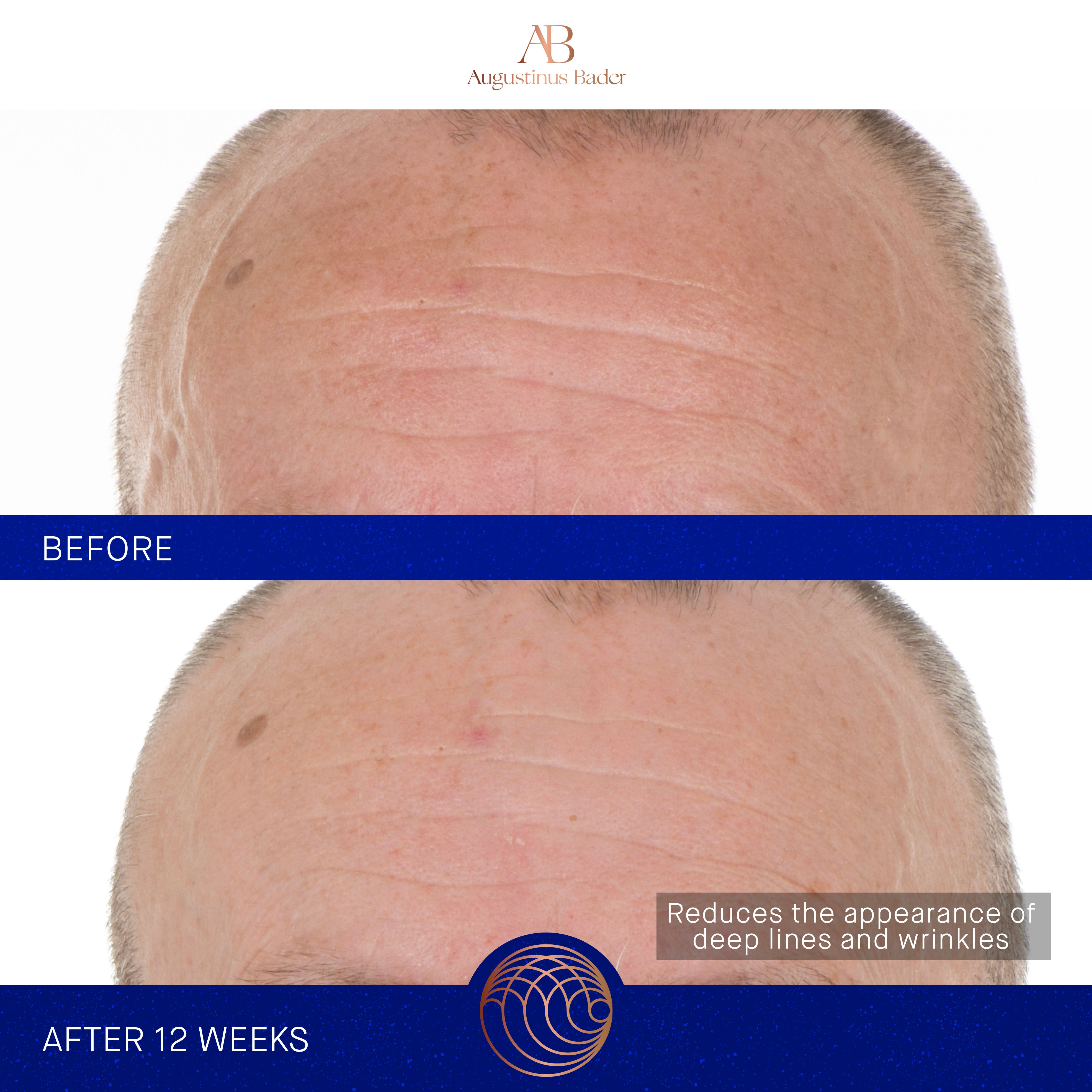 Augustinus Bader The Retinol Serum