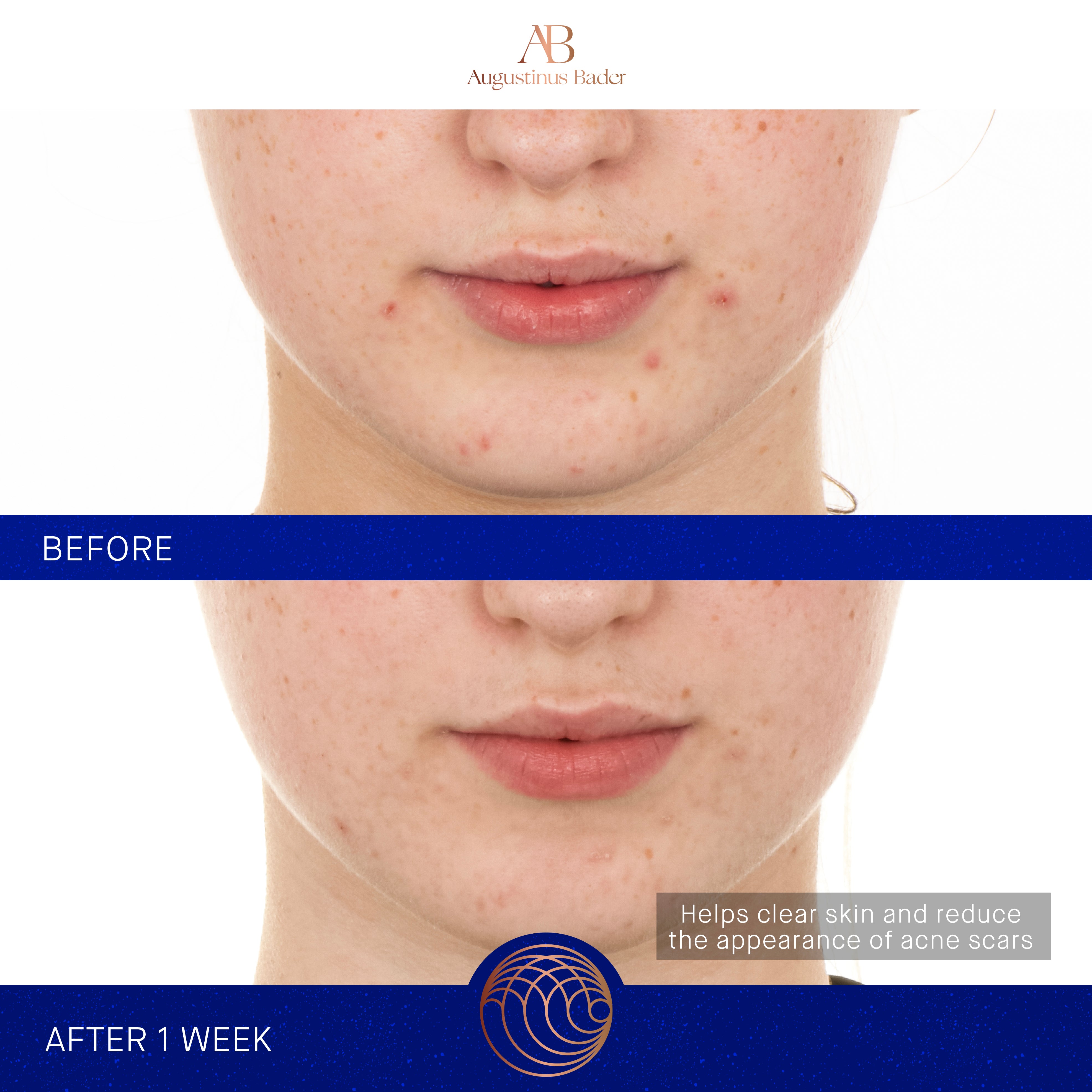 Augustinus Bader The Retinol Serum