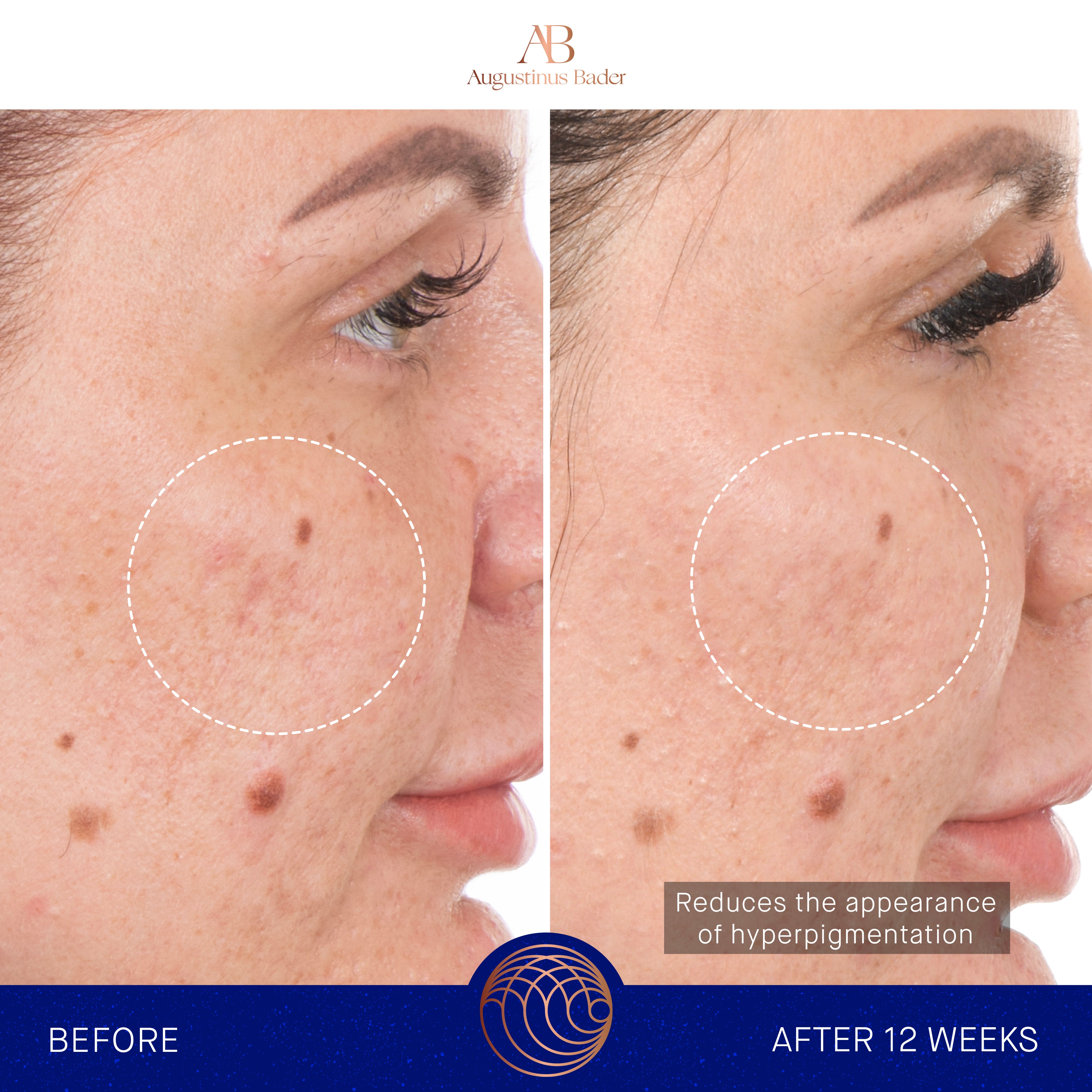 Augustinus Bader The Retinol Serum