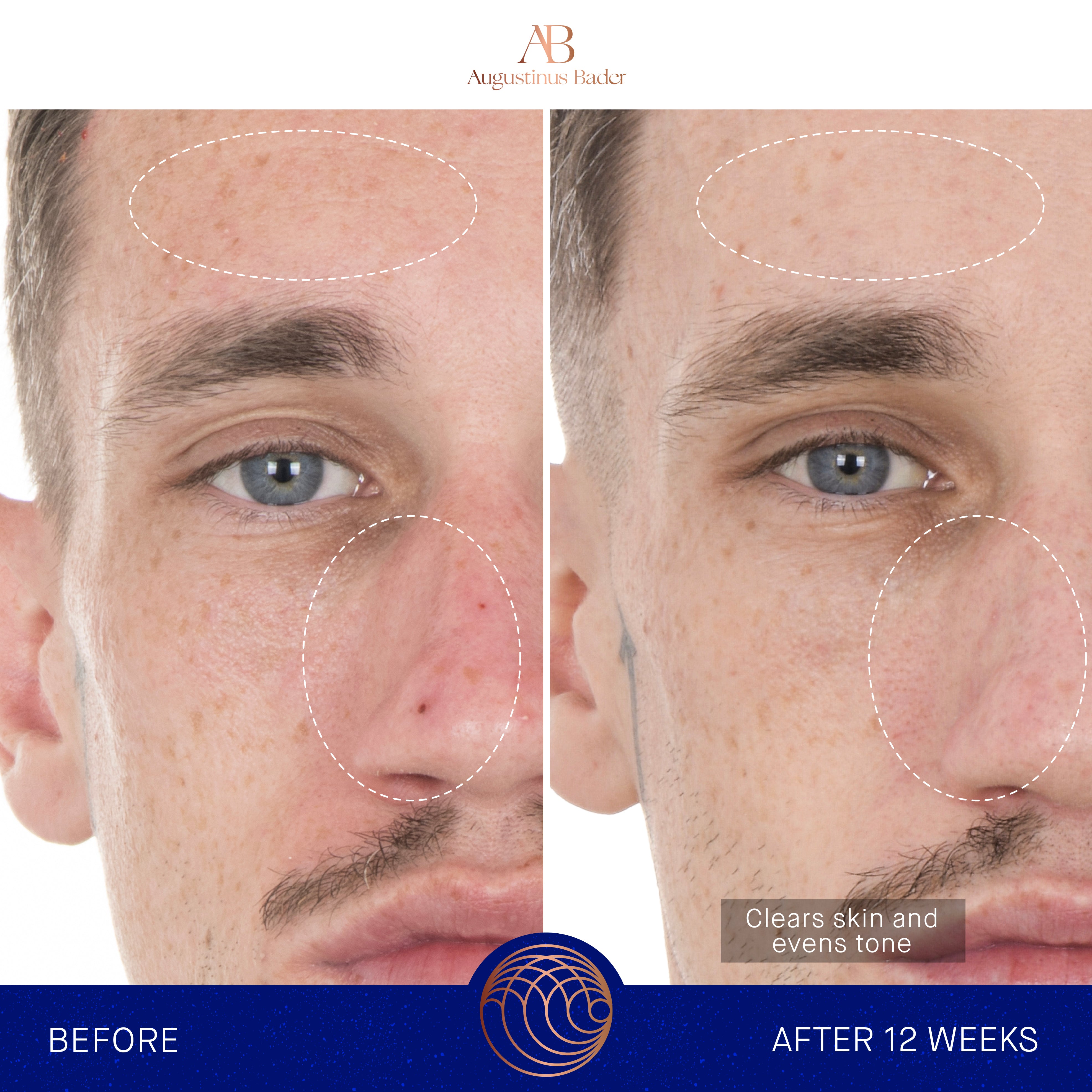 Augustinus Bader The Retinol Serum