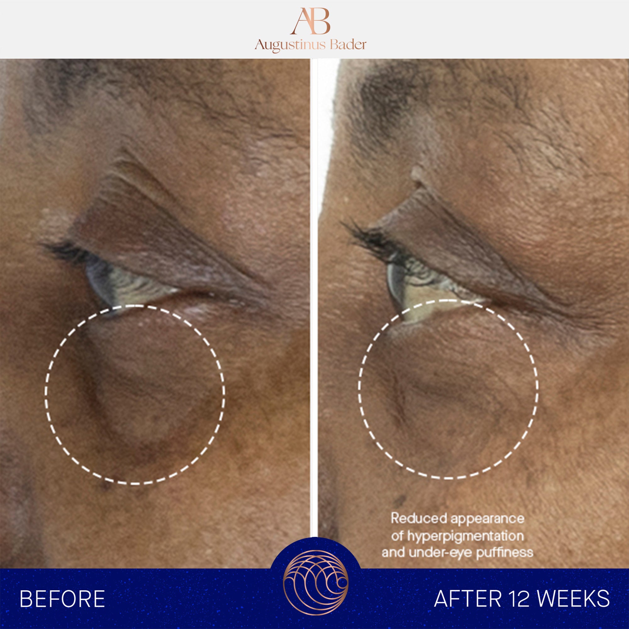 Augustinus Bader The Eye Cream