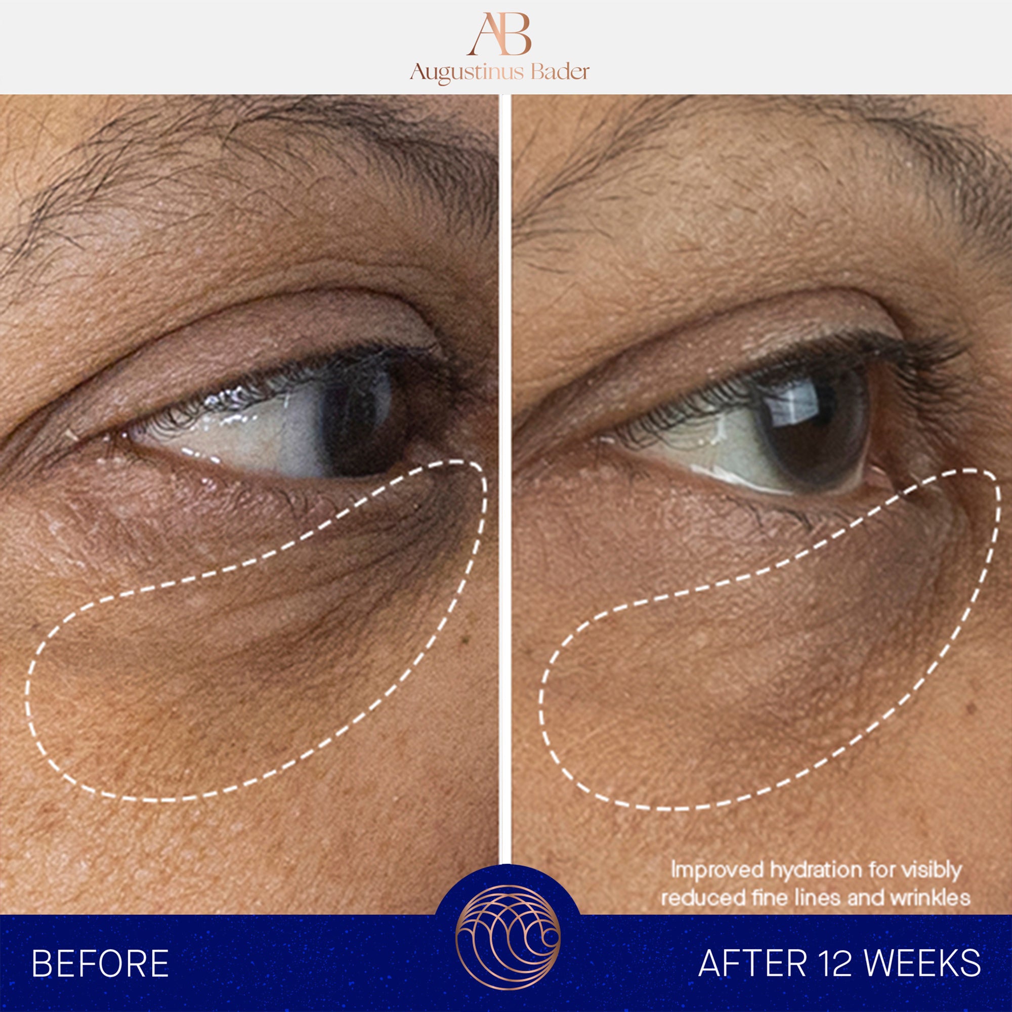 Augustinus Bader The Eye Cream