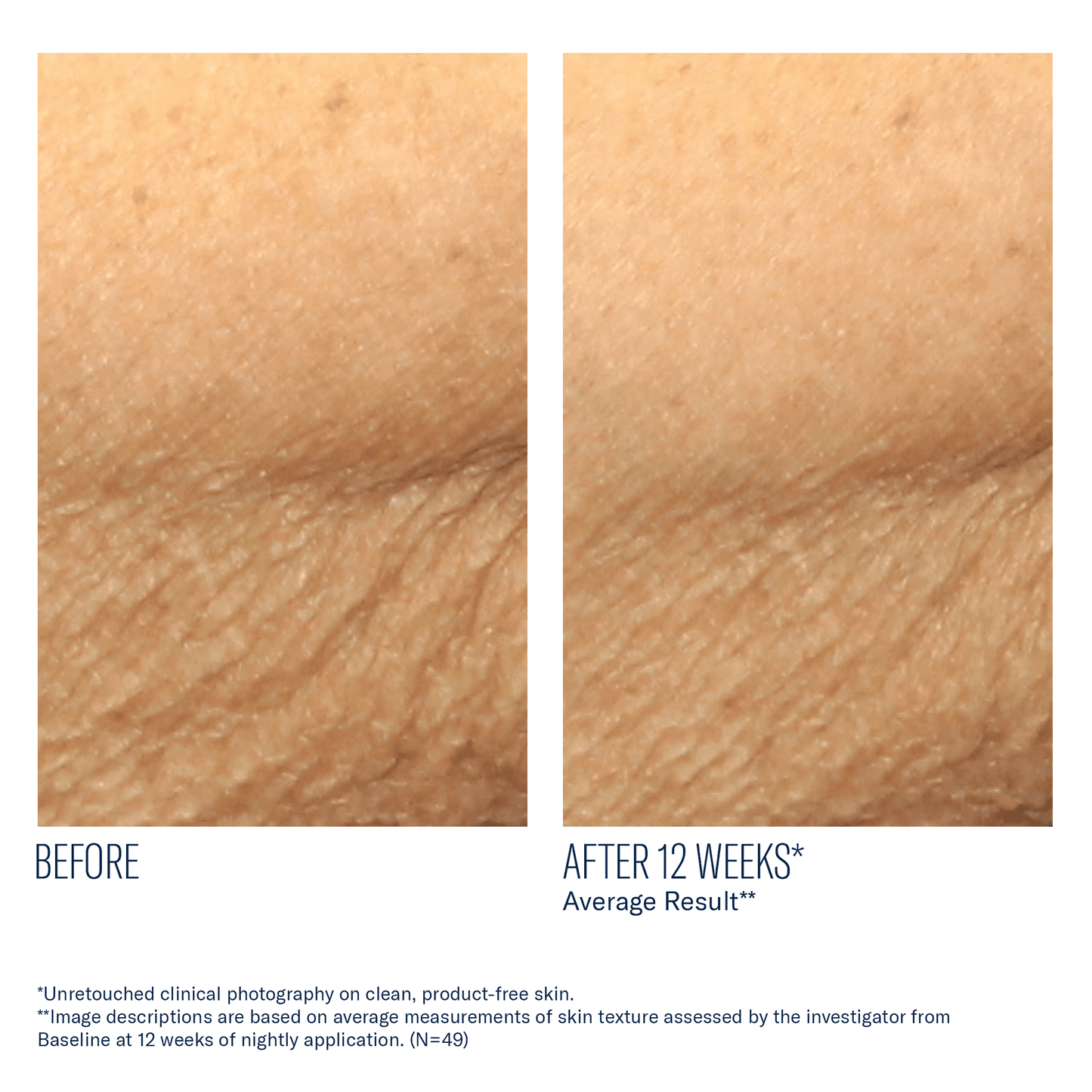 skinbetter AlphaRet Body Overnight Cream