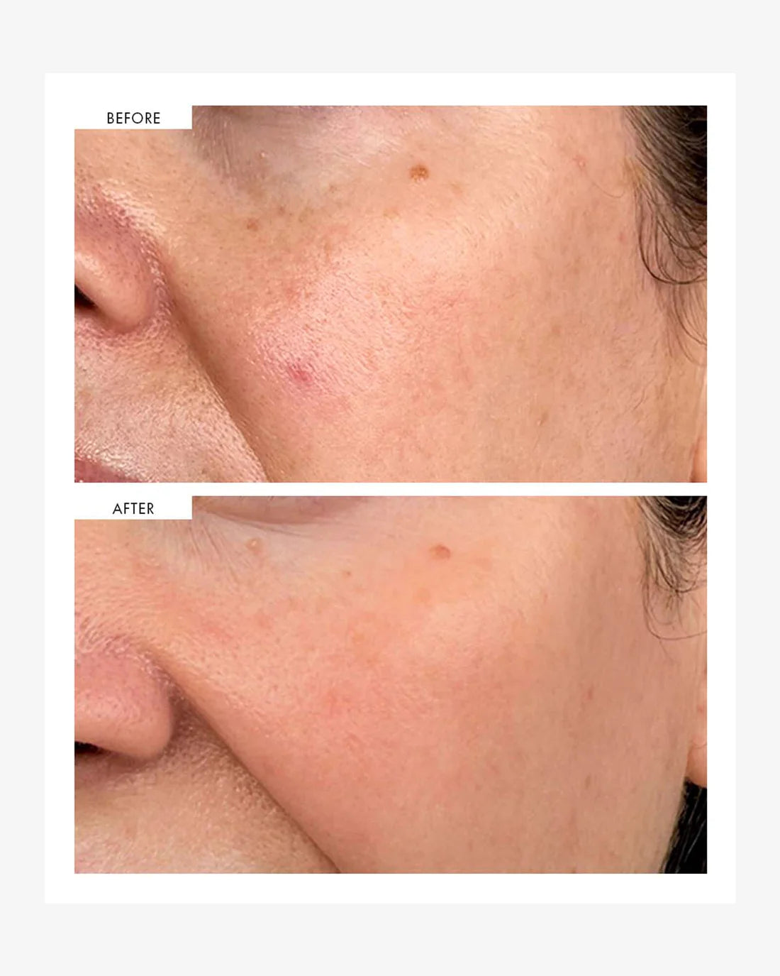 111SKIN Dark Spot Correcting Serum 30 mL