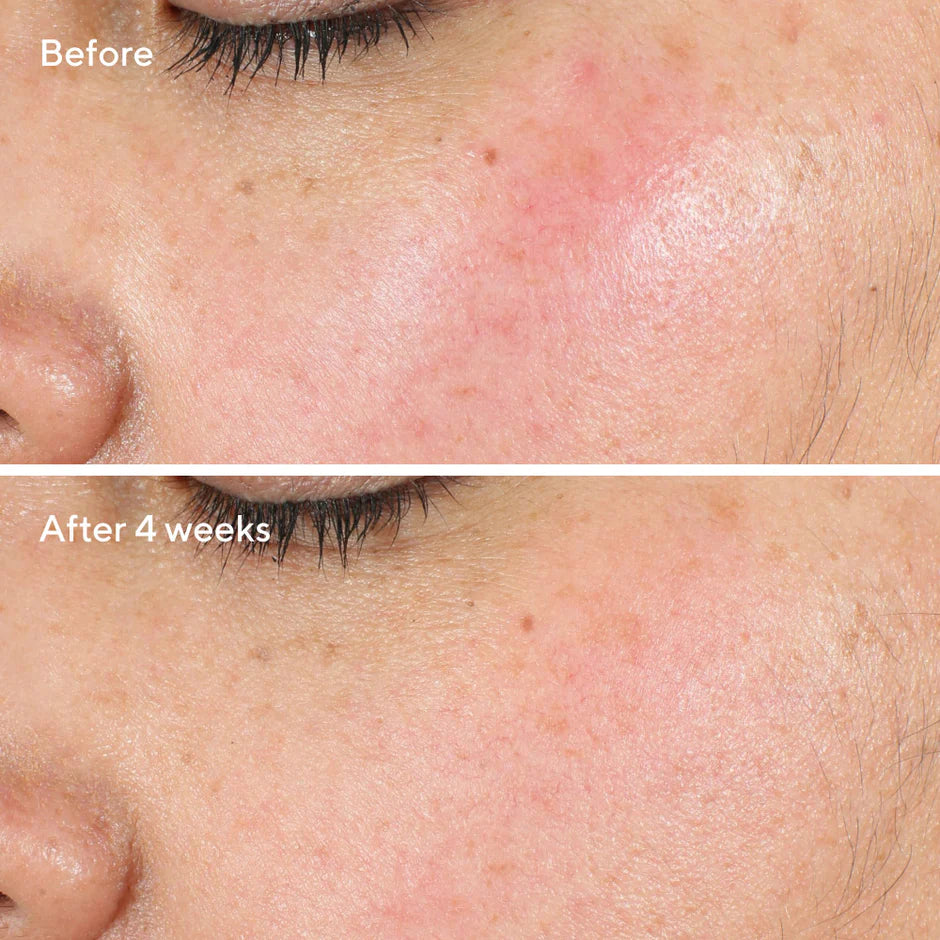Murad Intense Recovery Cream