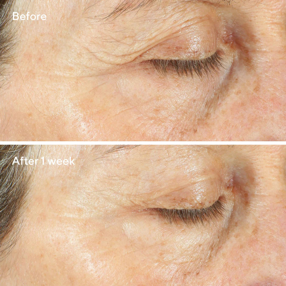Murad Intense Recovery Cream