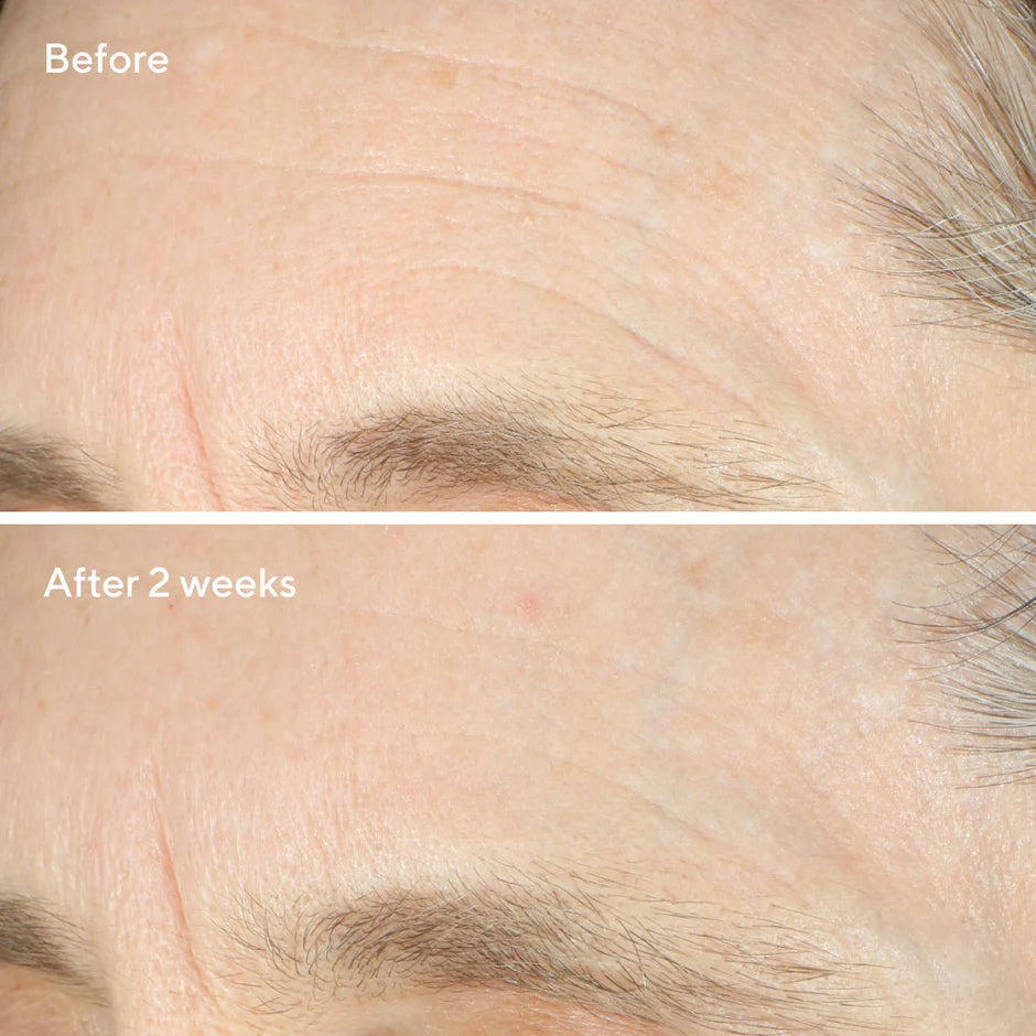 Murad Intense Recovery Cream