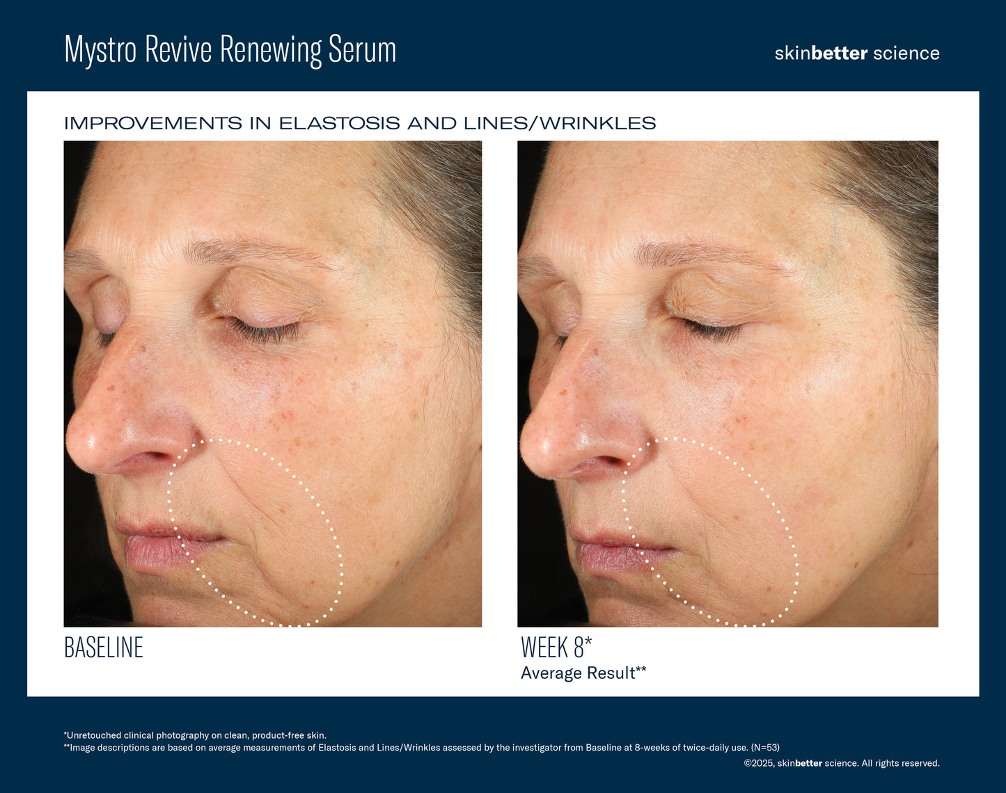 skinbetter Mystro Revive Renewing Serum