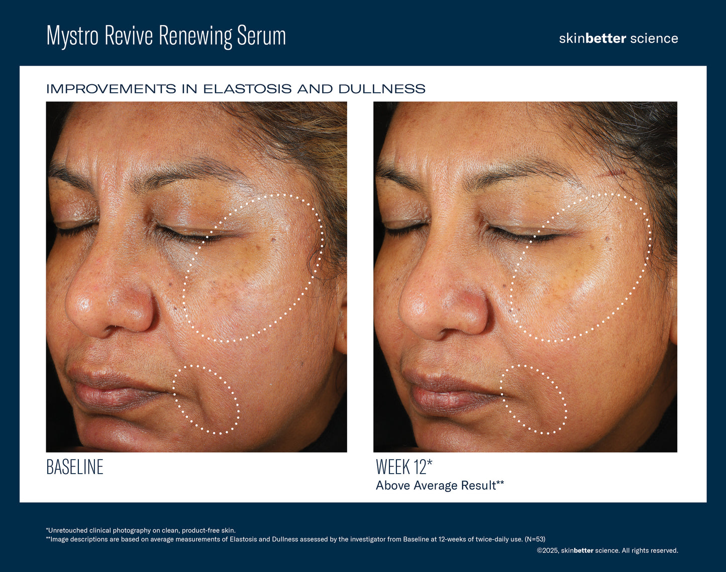 skinbetter Mystro Revive Renewing Serum