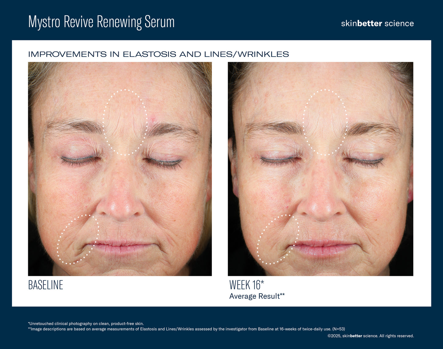 skinbetter Mystro Revive Renewing Serum
