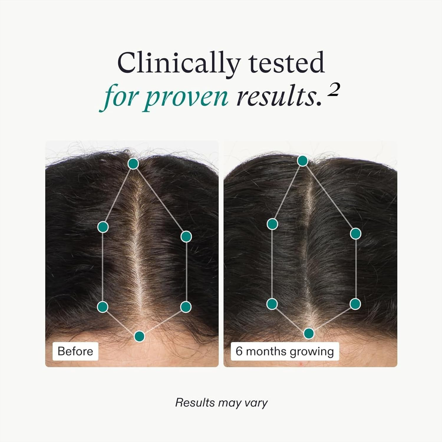 Nutrafol Women’s Hair Growth Nutraceutical Supplement