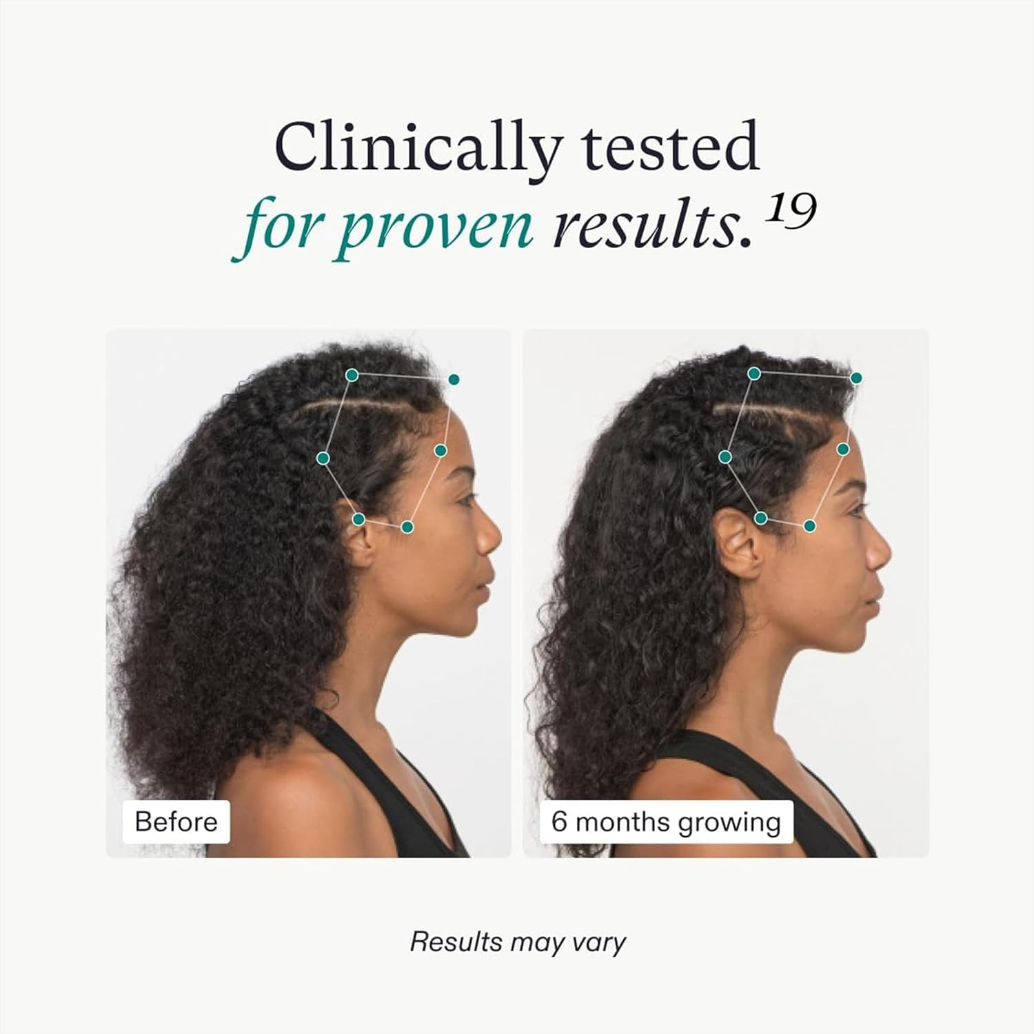 Nutrafol Women’s Vegan Hair Growth Nutraceutical Supplement
