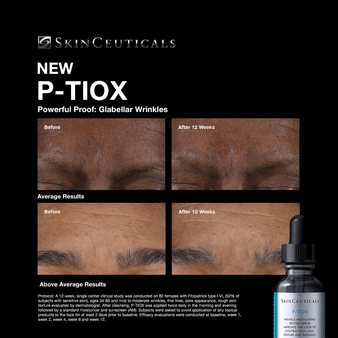 SkinCeuticals P-TIOX