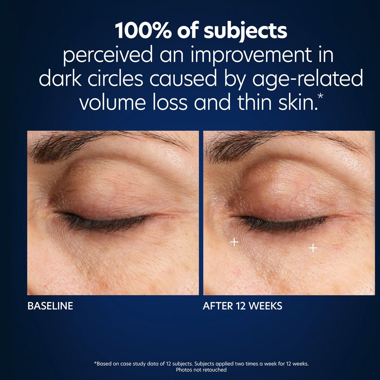 PCA Skin Hyaluronic Acid Microneedle Eye Patches