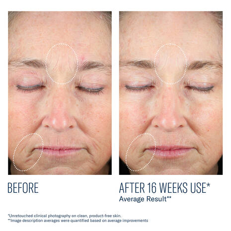 skinbetter Mystro Revive Renewing Serum