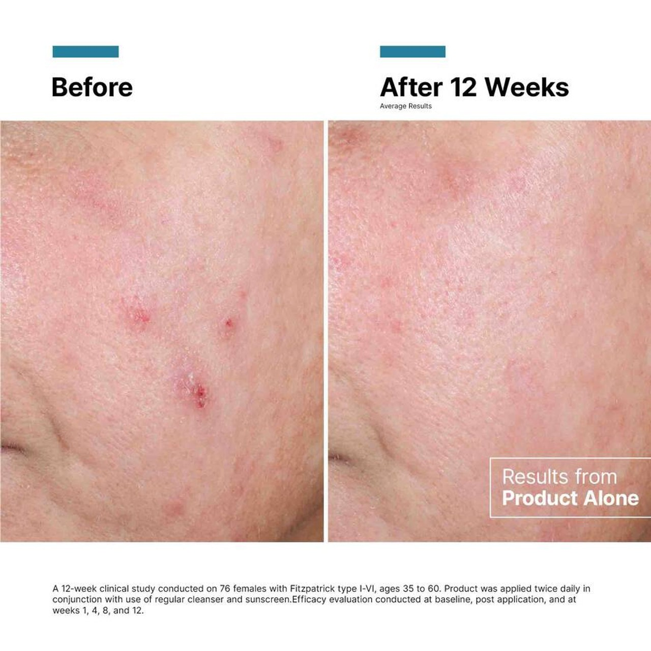 SkinCeuticals Advanced RGN-6