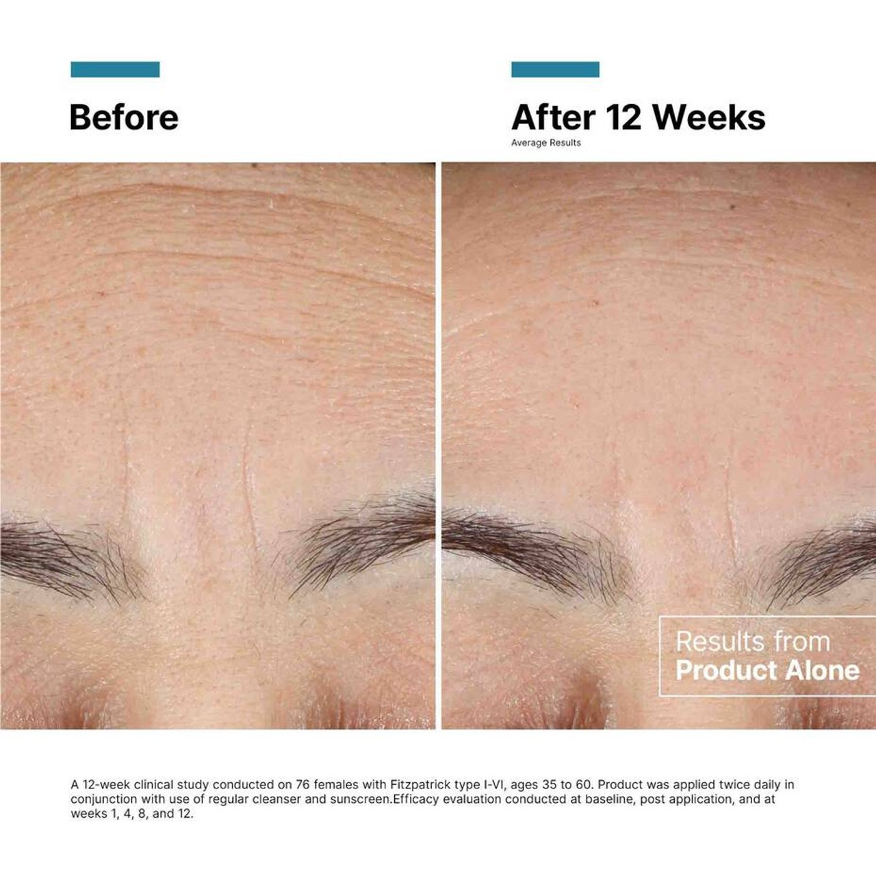 SkinCeuticals Advanced RGN-6