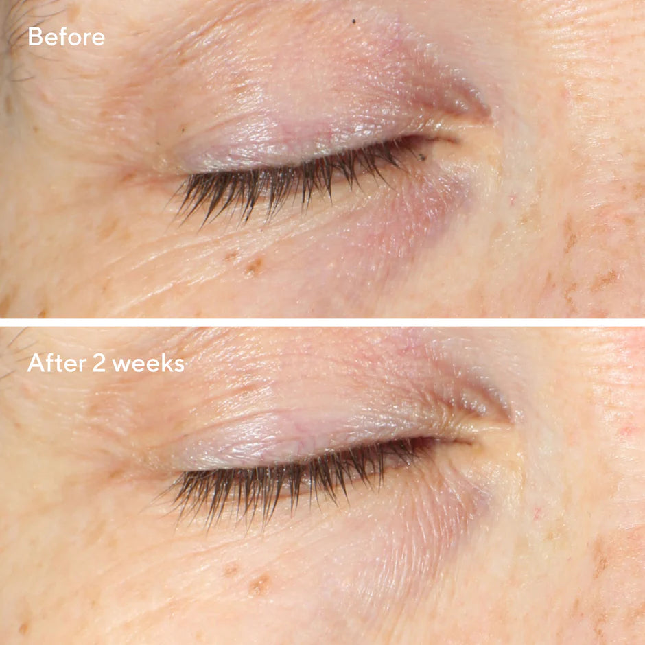 Murad Vita-C Eyes Dark Circle Corrector