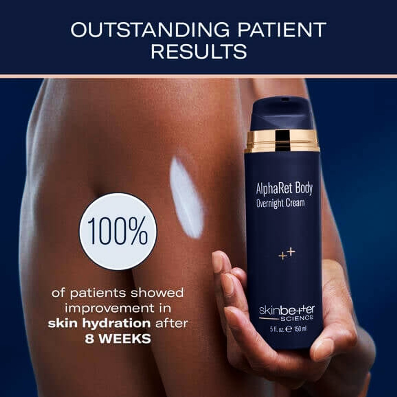 Skinbetter AlphaRet Body Overnight Cream