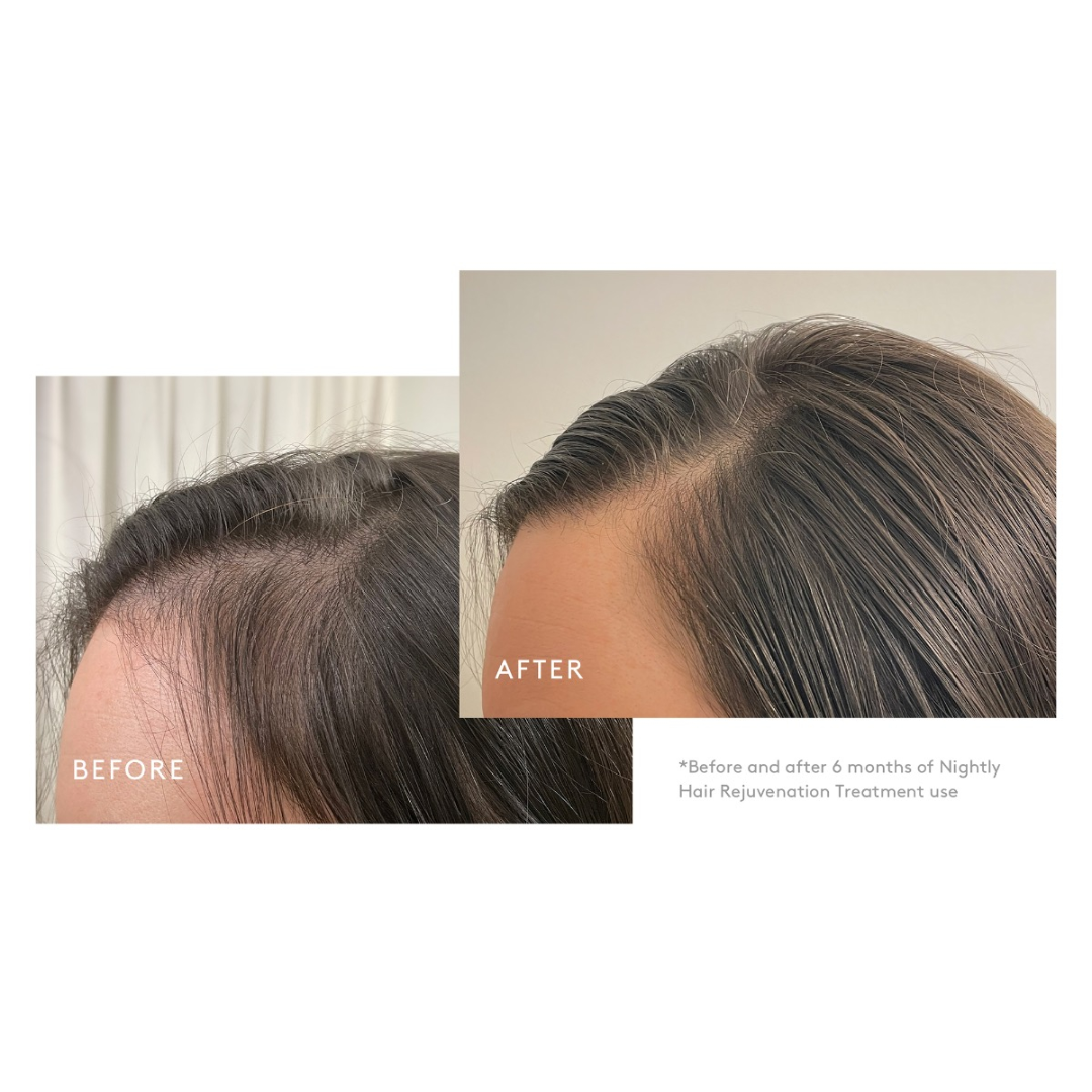 Virtue Flourish Nightly Intensive Hair Rejuvenation Treatment (30 Day)