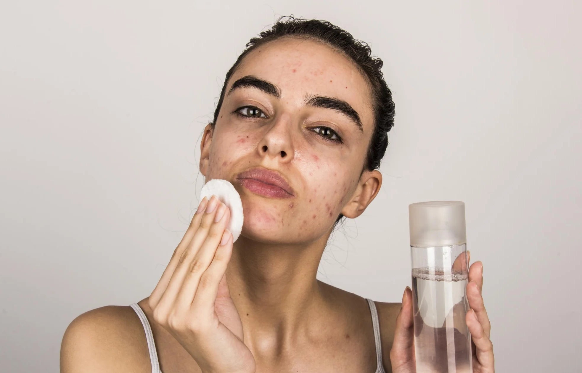 Banish Breakouts & Achieve Radiant Skin: How to Treat Acne-Prone Skin