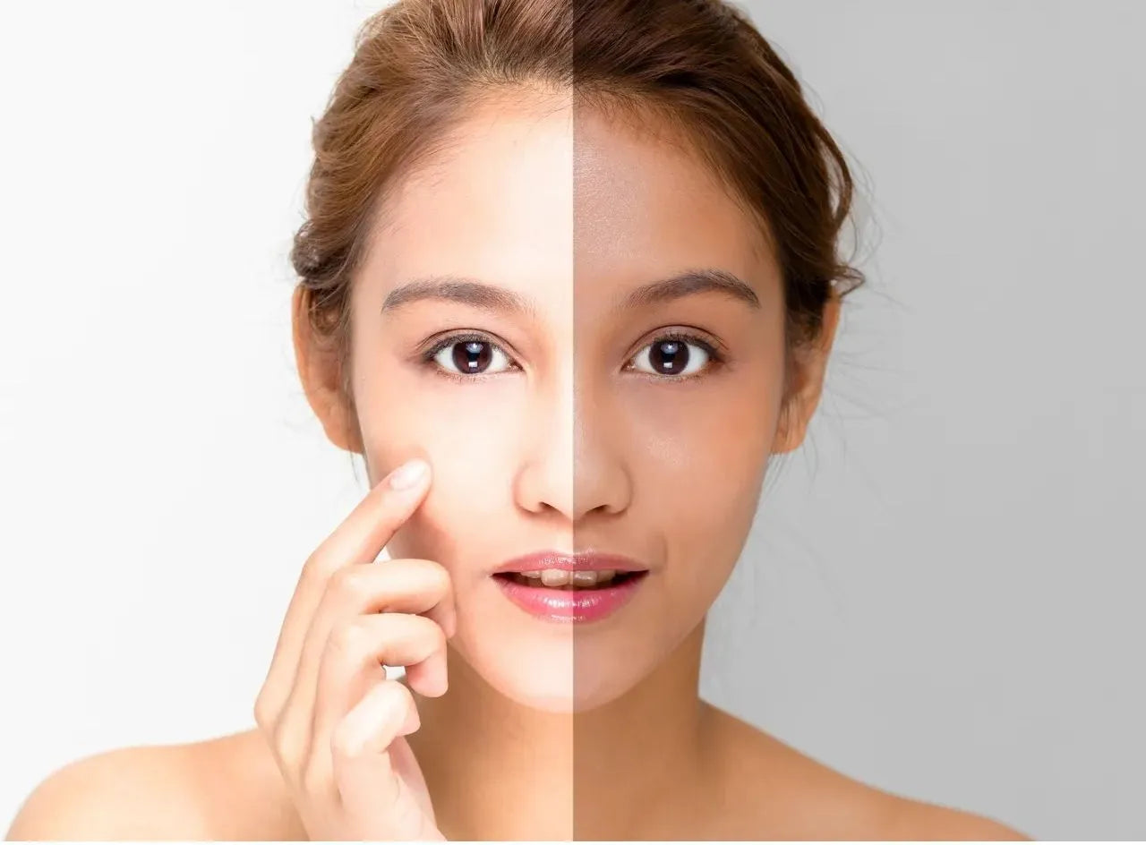 Does Skin Brightening Cream Really Work?