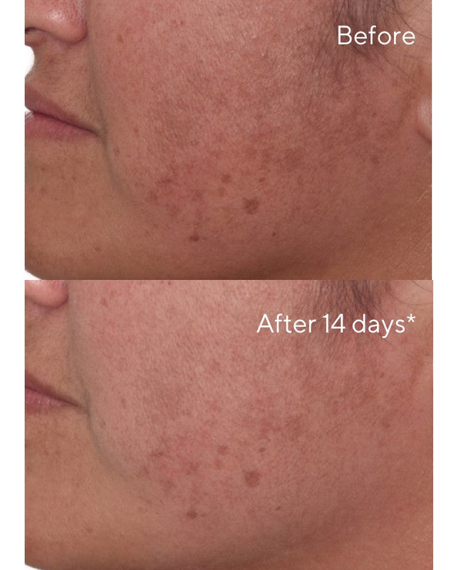 Murad Rapid Dark Spot Correcting Serum