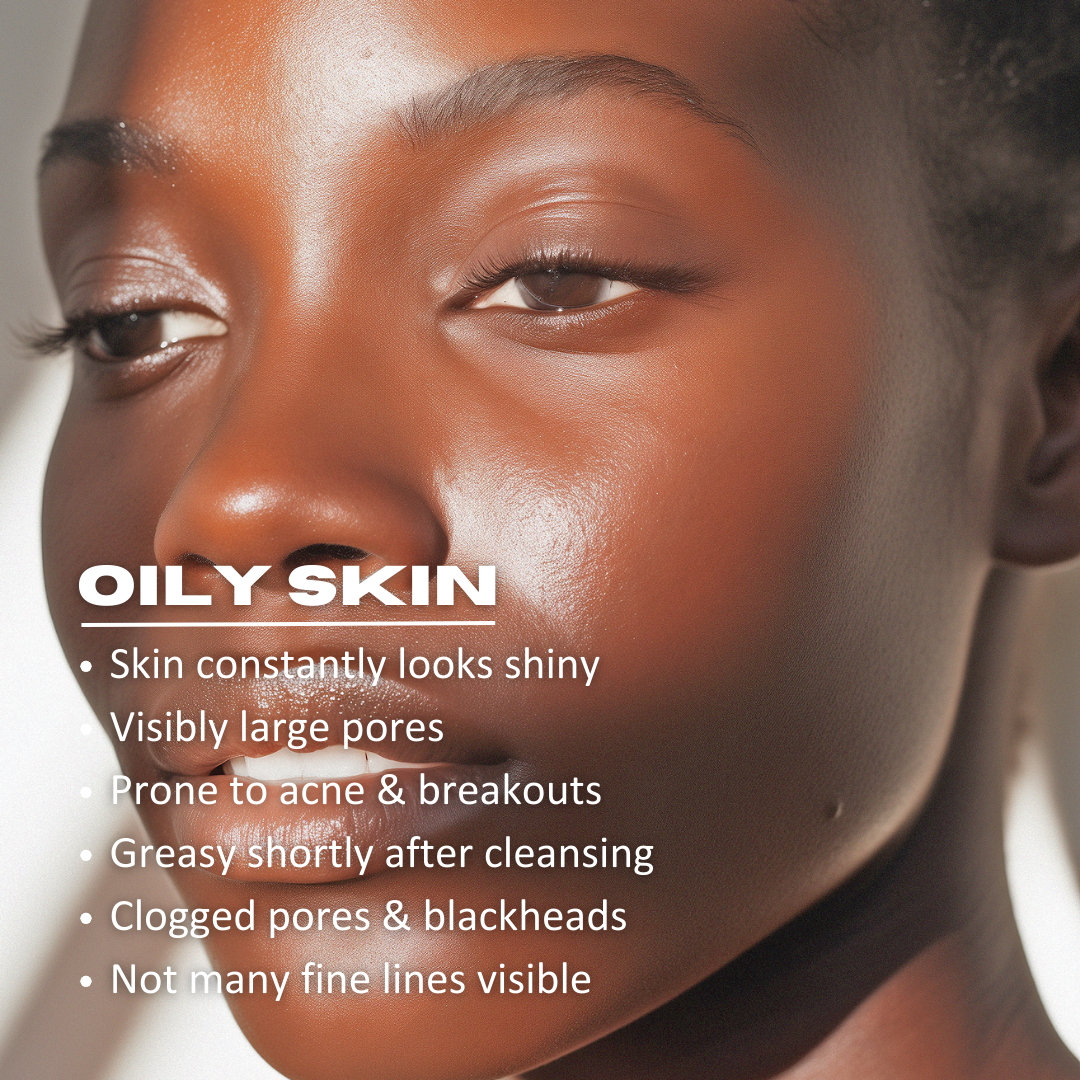 Oily Skin