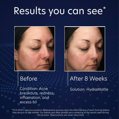 PCA Skin HydraMatte