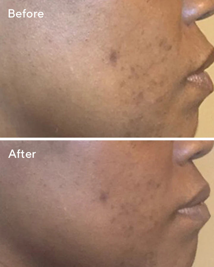 Murad Correct & Protect Serum Broad Spectrum SPF 45 | PA++++