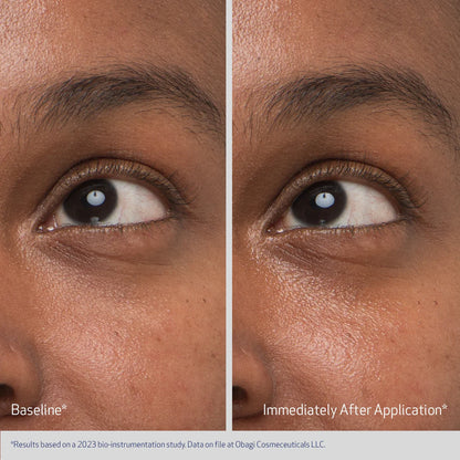 Obagi Rejuvenating Eye Gel Cream