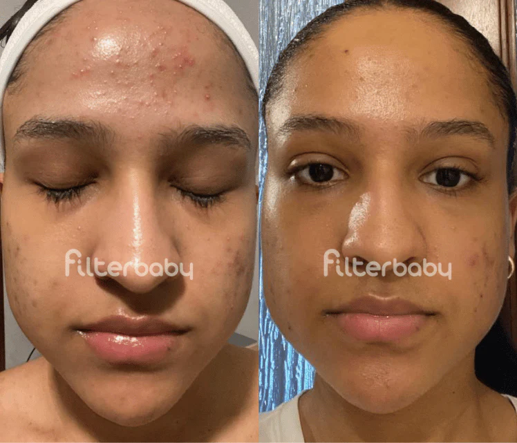 Filterbaby Skincare Filter Replacement 2.0