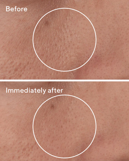 Murad Targeted Pore Corrector