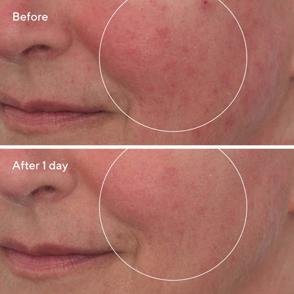 Murad Cellular Hydration Barrier Repair Sleep Mask