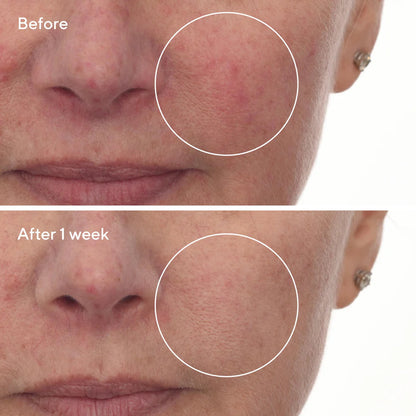 Murad Cellular Hydration Barrier Repair Serum