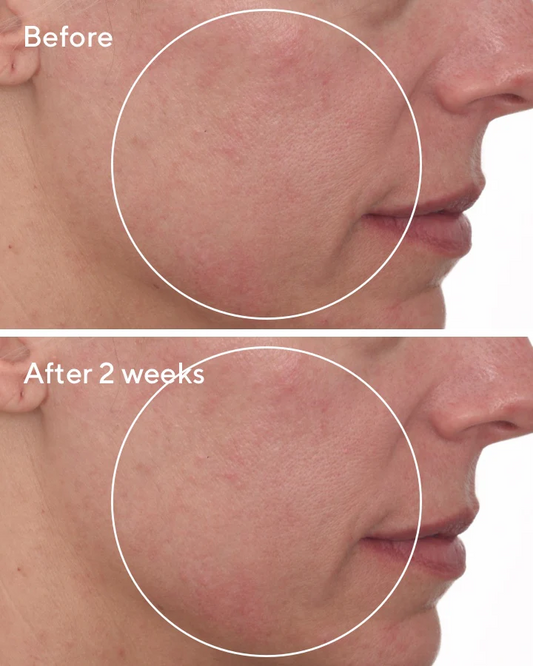 Murad Cellular Hydration Barrier Repair Cream Moisturizer