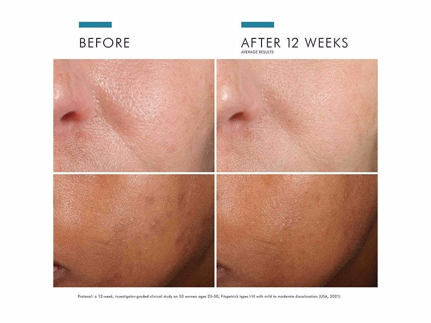 SkinCeuticals Phloretin CF