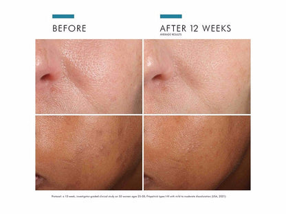 SkinCeuticals Phloretin CF